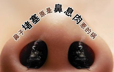 鼻息肉，耳鸣和听力减退，鼻窦炎，鼻息肉手术，眉山眼耳鼻咽喉专科医院.png