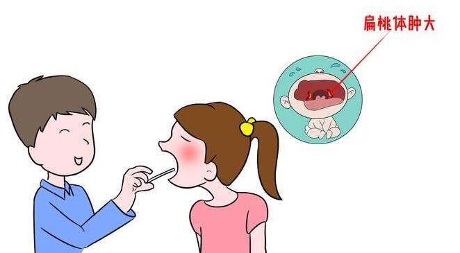 扁桃体发炎是什么原因，眉山耳鼻喉科专家，扁桃体发炎，.jpg